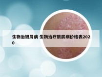生物治银屑病 生物治疗银屑病价格表2020