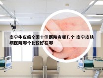 南宁牛皮癣全国十佳医院有哪几个 南宁皮肤病医院哪个比较好在哪
