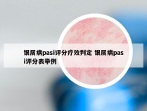 银屑病pasi评分疗效判定 银屑病pasi评分表举例