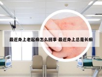 最近身上老起癣怎么回事 最近身上总是长癣