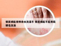 银屑病能用柳条水洗澡不 银屑病能不能用硫磺皂洗澡