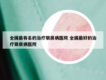 全国最有名的治疗银屑病医院 全国最好的治疗银屑病医院