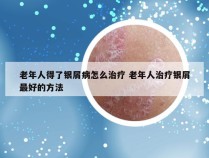 老年人得了银屑病怎么治疗 老年人治疗银屑最好的方法