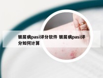 银屑病pasi评分软件 银屑病pasi评分如何计算