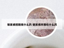 银屑病初期用什么药 银屑病早期吃什么药