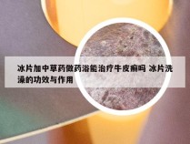冰片加中草药做药浴能治疗牛皮癣吗 冰片洗澡的功效与作用