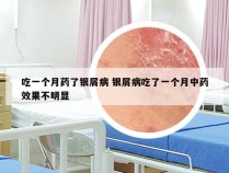 吃一个月药了银屑病 银屑病吃了一个月中药效果不明显