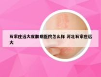 石家庄远大皮肤病医院怎么样 河北石家庄远大