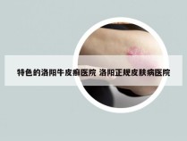 特色的洛阳牛皮癣医院 洛阳正规皮肤病医院