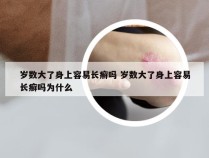 岁数大了身上容易长癣吗 岁数大了身上容易长癣吗为什么