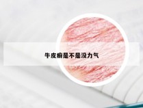 牛皮癣是不是没力气