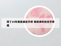得了10年银屑病关节疼 银屑病导致关节疼痛
