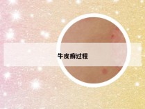 牛皮癣过程
