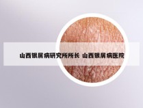 山西银屑病研究所所长 山西银屑病医院