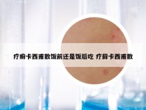 疗癣卡西甫散饭前还是饭后吃 疗藓卡西甫散