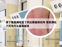得了银屑病吃完了药还要继续吃吗 银屑病吃了药为什么越来越多