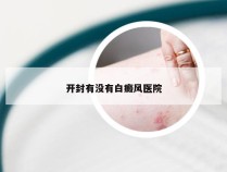 开封有没有白癜风医院