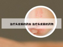 治疗头皮癣的药水 治疗头皮藓的药物