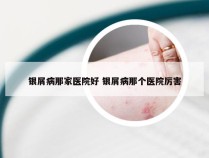 银屑病那家医院好 银屑病那个医院厉害