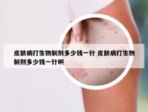 皮肤病打生物制剂多少钱一针 皮肤病打生物制剂多少钱一针啊