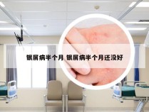 银屑病半个月 银屑病半个月还没好