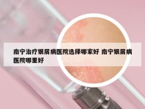 南宁治疗银屑病医院选择哪家好 南宁银屑病医院哪里好