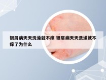 银屑病天天洗澡就不痒 银屑病天天洗澡就不痒了为什么
