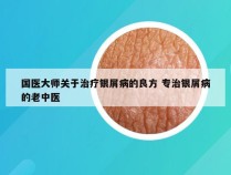 国医大师关于治疗银屑病的良方 专治银屑病的老中医
