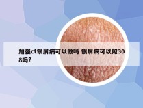 加强ct银屑病可以做吗 银屑病可以照308吗?