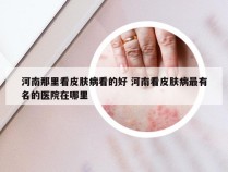 河南那里看皮肤病看的好 河南看皮肤病最有名的医院在哪里