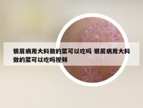银屑病用大料做的菜可以吃吗 银屑病用大料做的菜可以吃吗视频