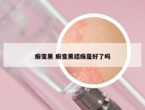 癣变黑 癣变黑结痂是好了吗