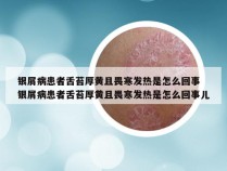 银屑病患者舌苔厚黄且畏寒发热是怎么回事 银屑病患者舌苔厚黄且畏寒发热是怎么回事儿