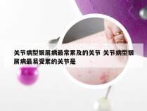 关节病型银屑病最常累及的关节 关节病型银屑病最易受累的关节是