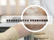 冬季皮癣怎么治疗方法 冬季皮肤长癣瘙痒