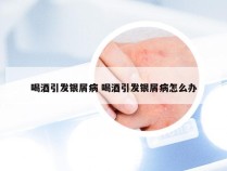喝酒引发银屑病 喝酒引发银屑病怎么办