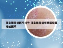 保定银屑病医院挂号 保定银屑病哪里医院最好的医院