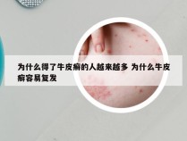 为什么得了牛皮癣的人越来越多 为什么牛皮癣容易复发