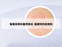 福建皮肤科医院排名 福建好的皮肤科