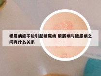 银屑病能不能引起糖尿病 银屑病与糖尿病之间有什么关系
