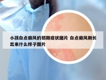 小孩白点癫风的初期症状图片 白点癫风刚长出来什么样子图片