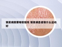 银屑病需要哪些锻炼 银屑病患者做什么运动好