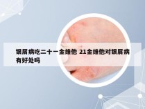 银屑病吃二十一金维他 21金维他对银屑病有好处吗