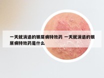 一天就消退的银屑病特效药 一天就消退的银屑病特效药是什么