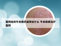 医院给的牛皮癣药通常给什么 牛皮肤癣治疗医院