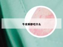牛皮癣都吃什么