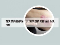 苗天然药膏都治什么 苗天然药膏都治什么及价格