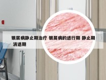 银屑病静止期治疗 银屑病的进行期 静止期 消退期