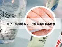 长了一小块癣 长了一小块癣而且有小疙瘩