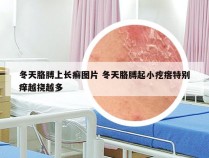 冬天胳膊上长癣图片 冬天胳膊起小疙瘩特别痒越挠越多